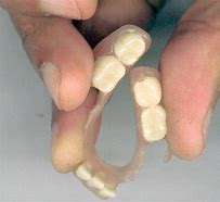 Image result for What Does a Flipper Tooth Look Like