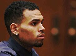 Image result for Rihanna Chris Brown Injuries