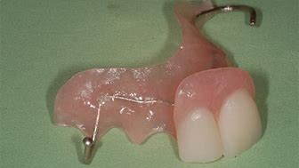 Image result for Flipper Dental Appliance