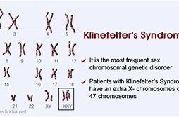 Image result for Klinefelter Syndrome Treatment