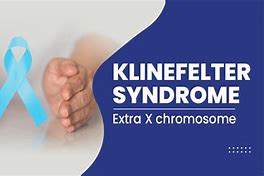 Image result for How to Prevent Klinefelter Syndrome