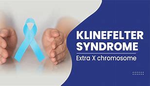 Image result for How Common Is Klinefelter Syndrome