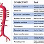 Image result for Aortic Dissection Radiology