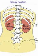 Image result for Kidney Pain