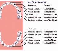 Image result for Bacterie Sur Les Dents