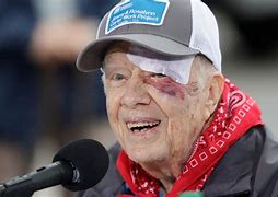 Image result for Jimmy Carter Fall