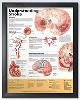 Image result for Stroke Anatomy