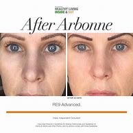 Image result for Arbonne Wrinkles Before After