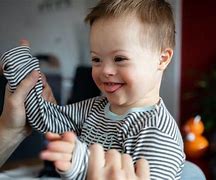 Image result for Down Syndrome Causes