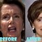 Image result for Nancy Pelosi Plastic Face