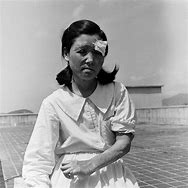 Image result for Atomic Bomb Japan Survivors
