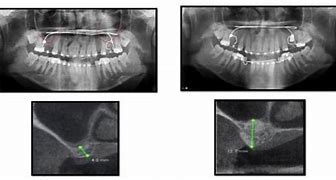 Image result for CBCT Scan