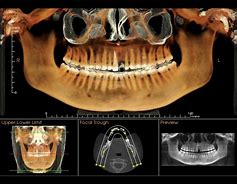 Image result for Dental CT Scan Machine