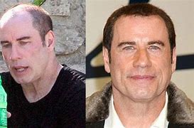 Image result for John Travolta without a Wig