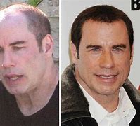 Image result for John Travolta Bad Plastic Surgery