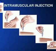 Image result for Intramuscular Injection Procedure