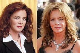 Image result for Stockard Channing Plastic Surgery Disasters