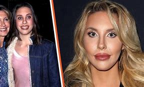 Image result for Chloe Newton-John Before and After