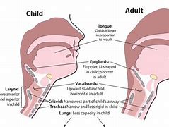 Image result for Adult vs Pediatric Anatomy