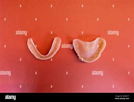 Image result for False Teeth Dentures