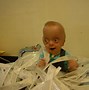 Image result for Boy Gregory Pfeiffer Syndrome
