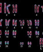 Image result for XXY Karyotype