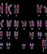 Image result for People with XXY Chromosome