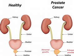 Image result for Prostate Gland Anatomy