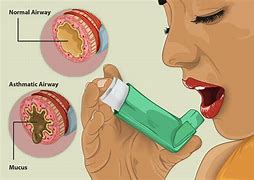 Image result for Asthma Breathing