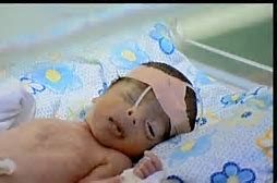 Image result for iraq fallujah babies deformed