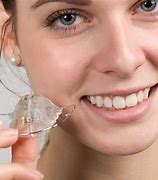 Image result for Removable Braces Teeth