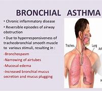 Image result for Bronchial Asthma Disease