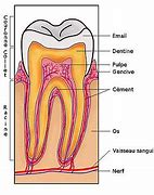 Image result for Dents in Den