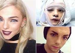 Image result for Chloe Prince Transgender Woman Before and After