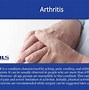 Image result for Orthopedic Pain