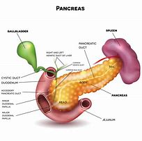 Image result for Pancreatic Cancer Types