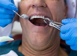Image result for Dentist Surgery