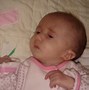 Image result for Babies with Edwards Syndrome