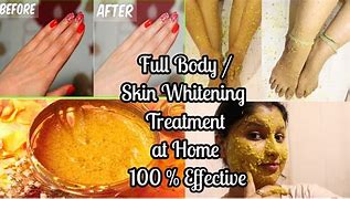 Image result for Skin Whitening Home Remedies