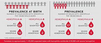 Image result for Hemophilia Statistics