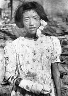 Image result for Atomic Bomb Japan Survivors