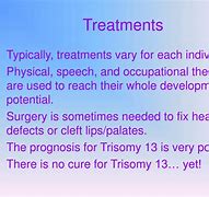Image result for Treatment of Trisomy 13 Syndrome