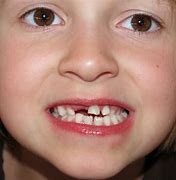 Image result for Hideki Tojo Teeth