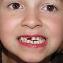 Image result for Teeth Cleaning Kit