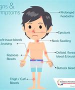 Image result for Hemophilia Syndrome