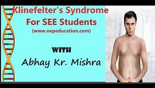 Image result for What Is Klinefelter Syndrome