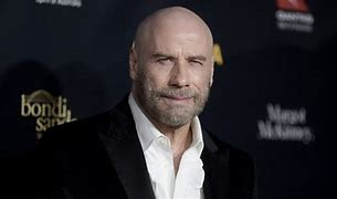 Image result for John Travolta Losing Hair