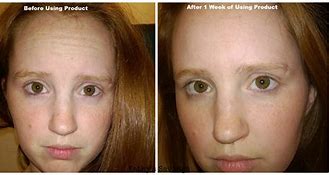 Image result for Skin Firming Cream Before and After