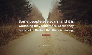 Image result for Quotes About Scars