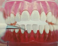 Image result for Water Picks for Teeth Cleaning